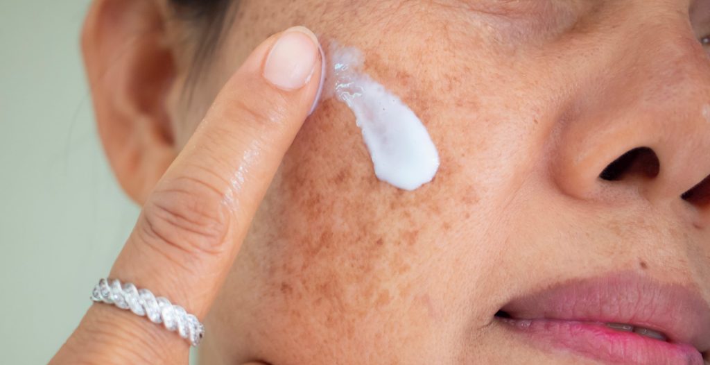 mujer aplica una de las mejores cremas antimanchas