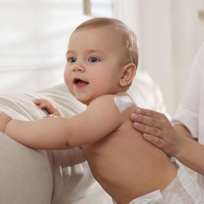 cremas para piel atópica de bebé