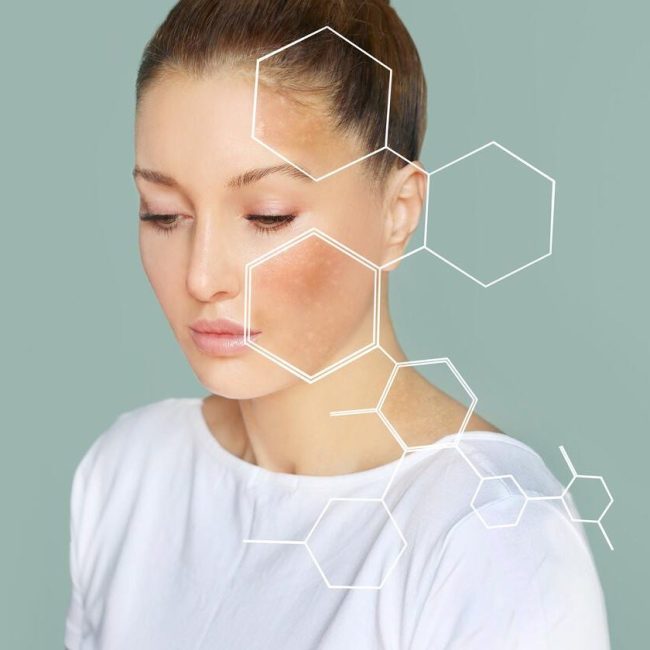 mejores desigmentantes faciales