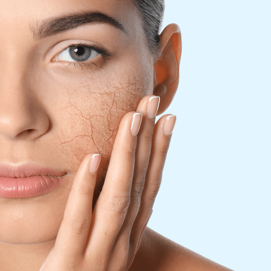 piel deshidratada causas y tratamientos