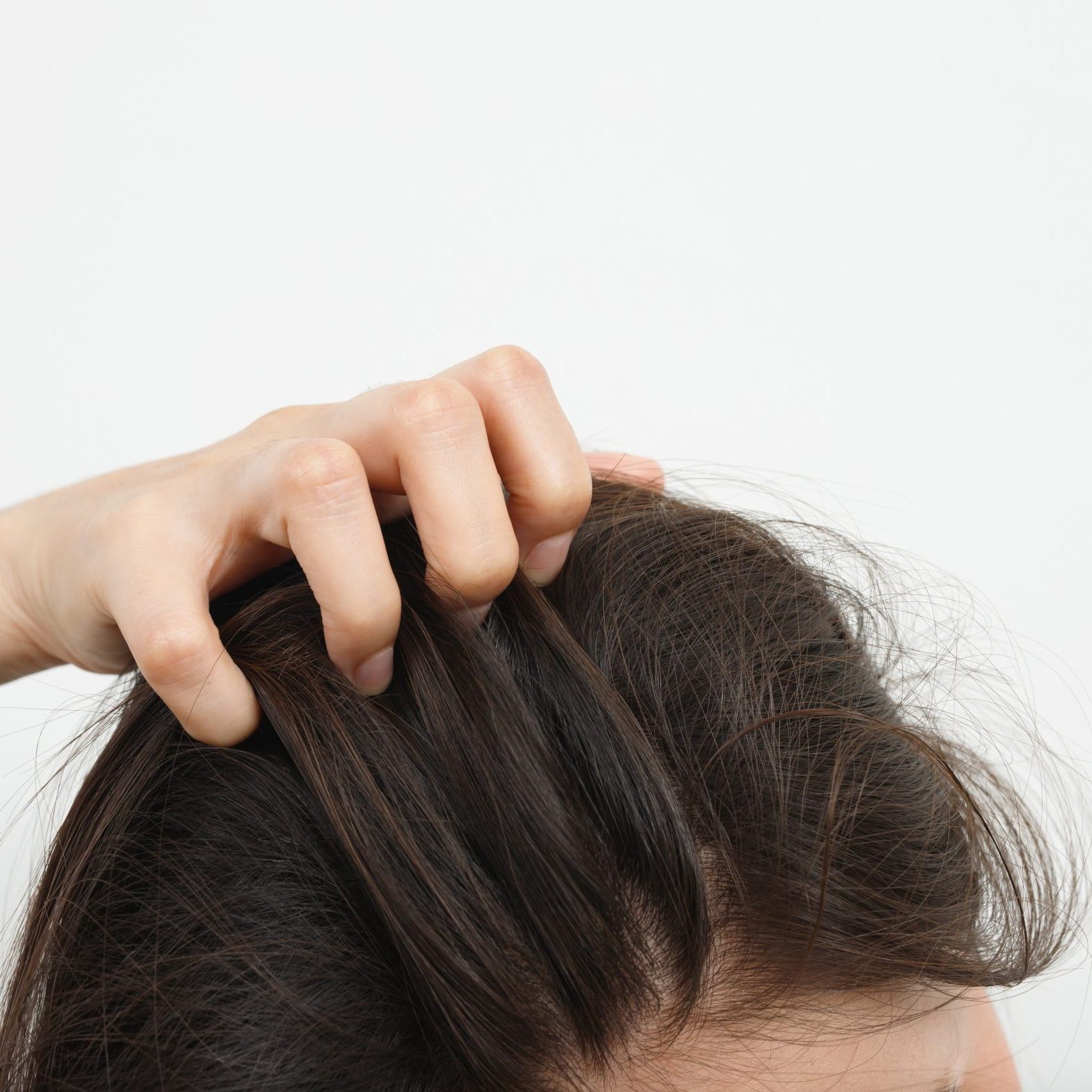 mujer con picor en el cabello