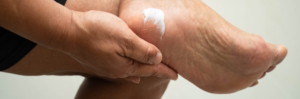 mejores cremas de pies
